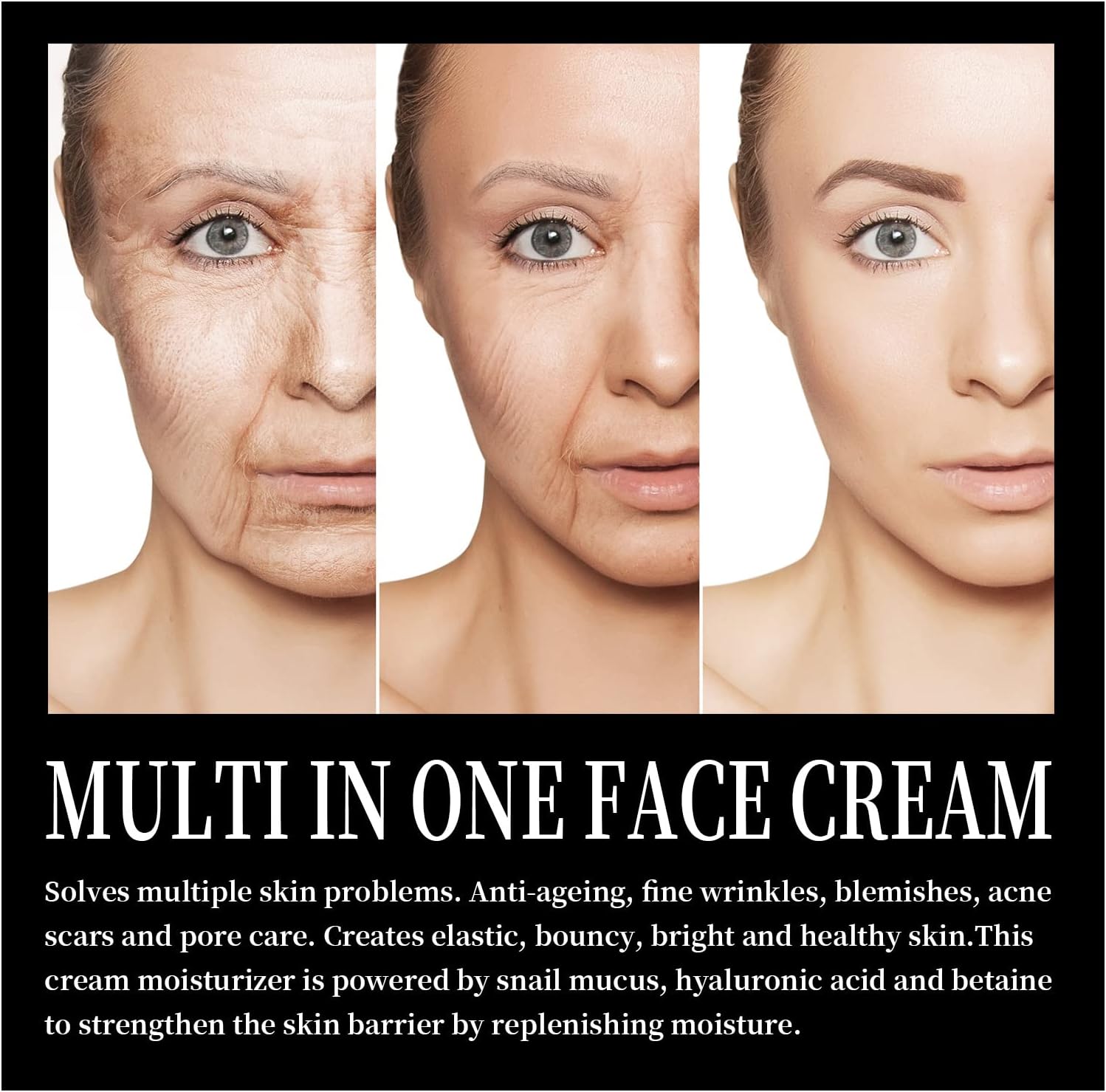 Ouhoe Advanced Snail 92 All-in-One Cream - 100g Ouhoe Advanced Snail 92 All-in-One Cream - 100g