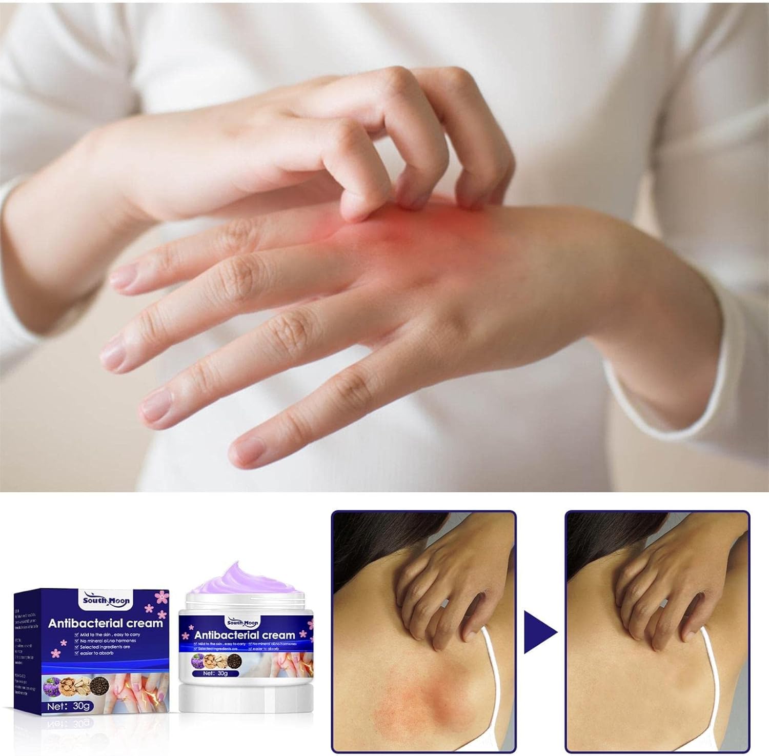 South Moon Antibacterial Cream 30g South Moon Antibacterial Cream 30g