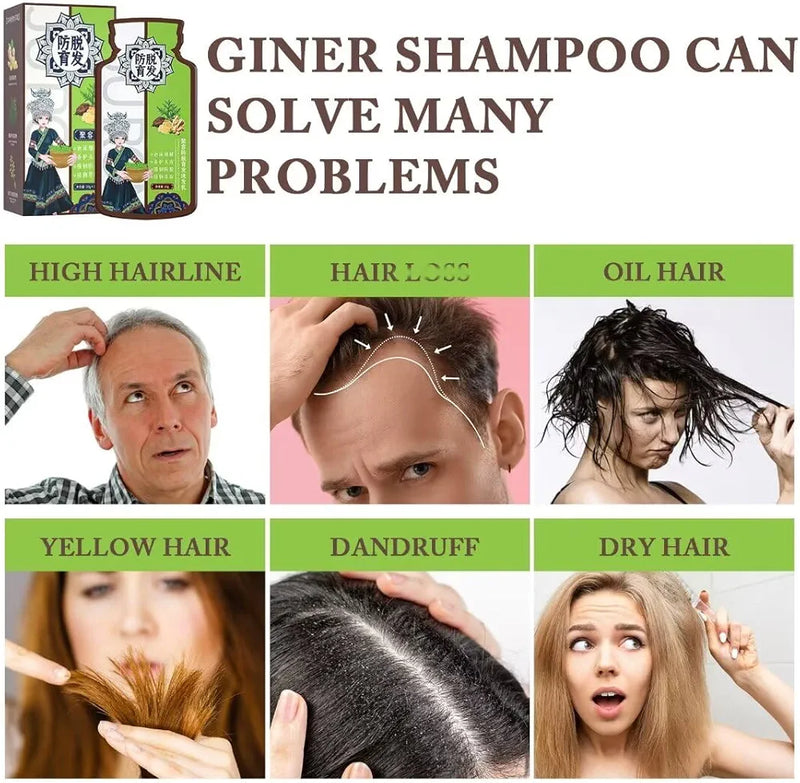 Ginger Plant Extract Convolute Anti-Hair Loss Shampoo