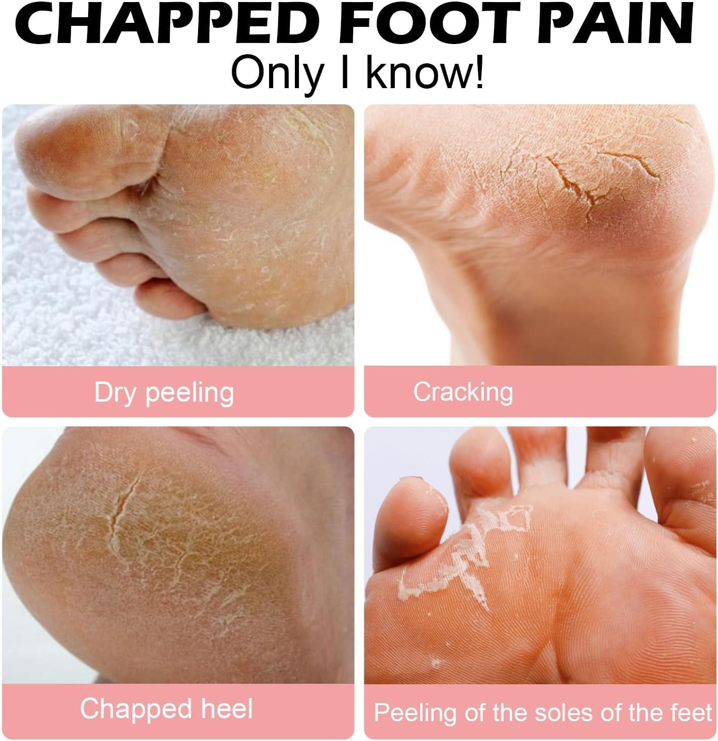 Foot Care Cream Cracked Feet, Crack Feet Prevention Stick, FootBalm, Foot Balm Stick for Dry Cracked Feets, Anti Cracking Foot Cream Roll On, Hydrating FT22 Foot Care Cream Cracked Feet, Crack Feet Prevention Stick, FootBalm, Foot Balm Stick for Dry Cracked Feets, Anti Cracking Foot Cream Roll On, Hydrating FT22
