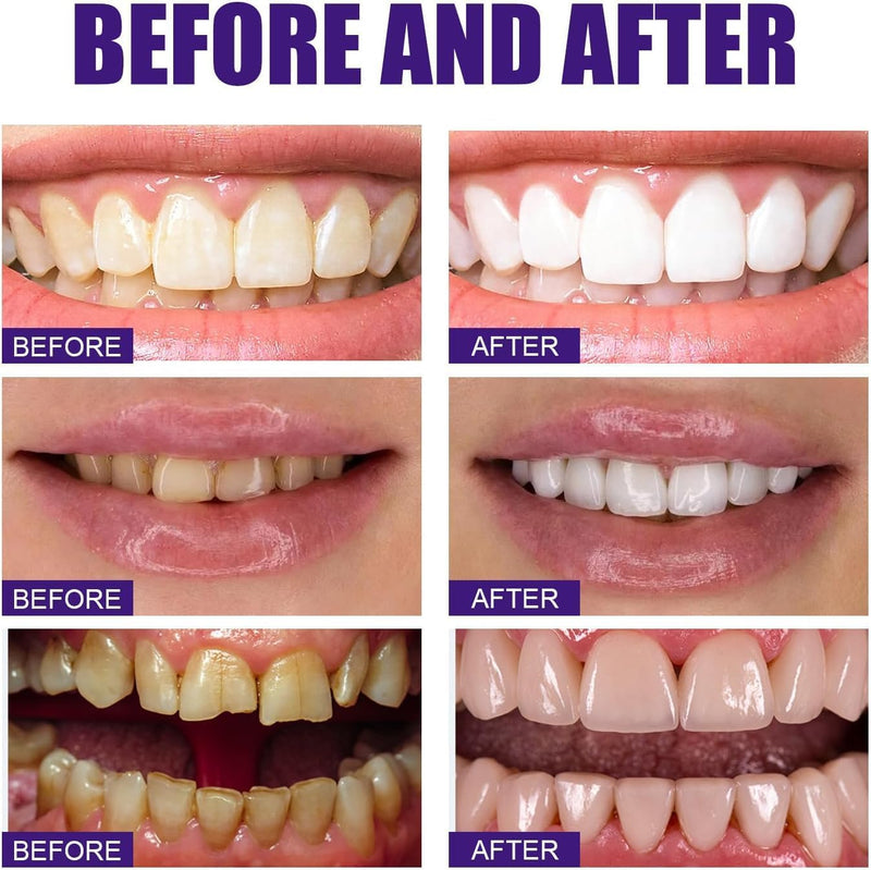 V34 Colour Correction, Purple Teeth Whitening Toothpaste Jaysuing