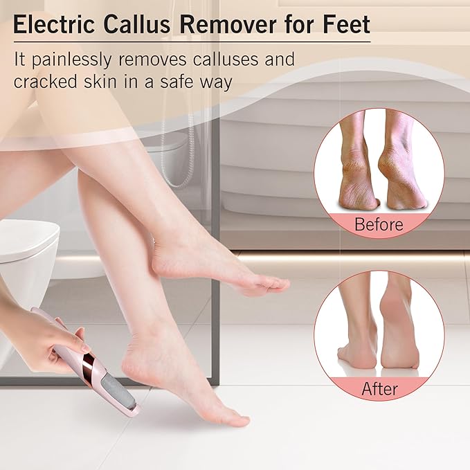 Electric Foot File, Electric Callus Removers for Feet 140656 - TUZZUT Qatar Online Shopping