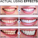 EEIHOE 3 Days Teeth Whitening Powder 80ml - TUZZUT Qatar Online Shopping