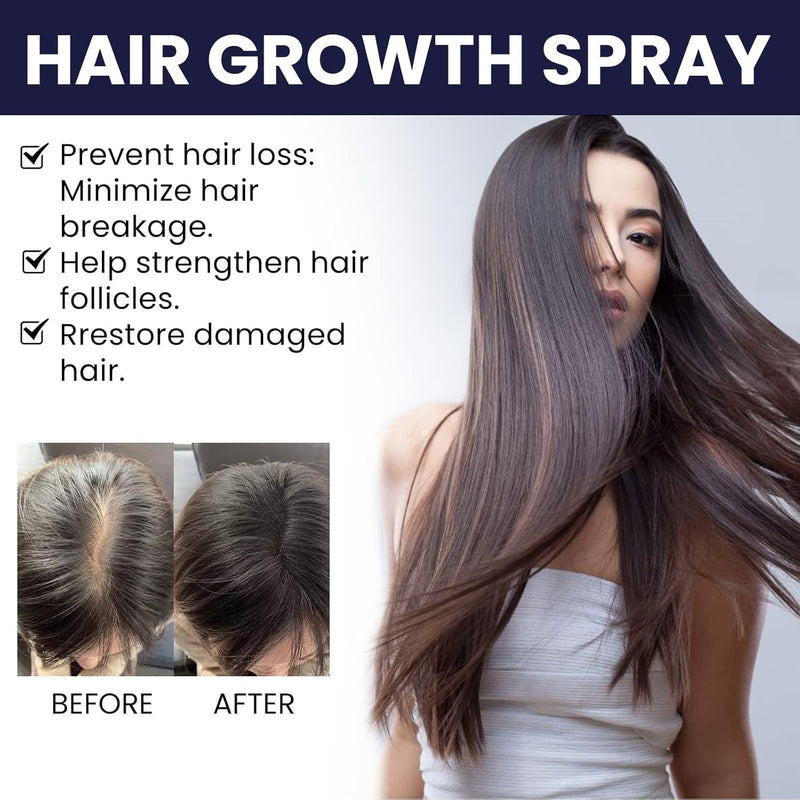 OUHOE Hair Growth Spray 50ml - TUZZUT Qatar Online Shopping