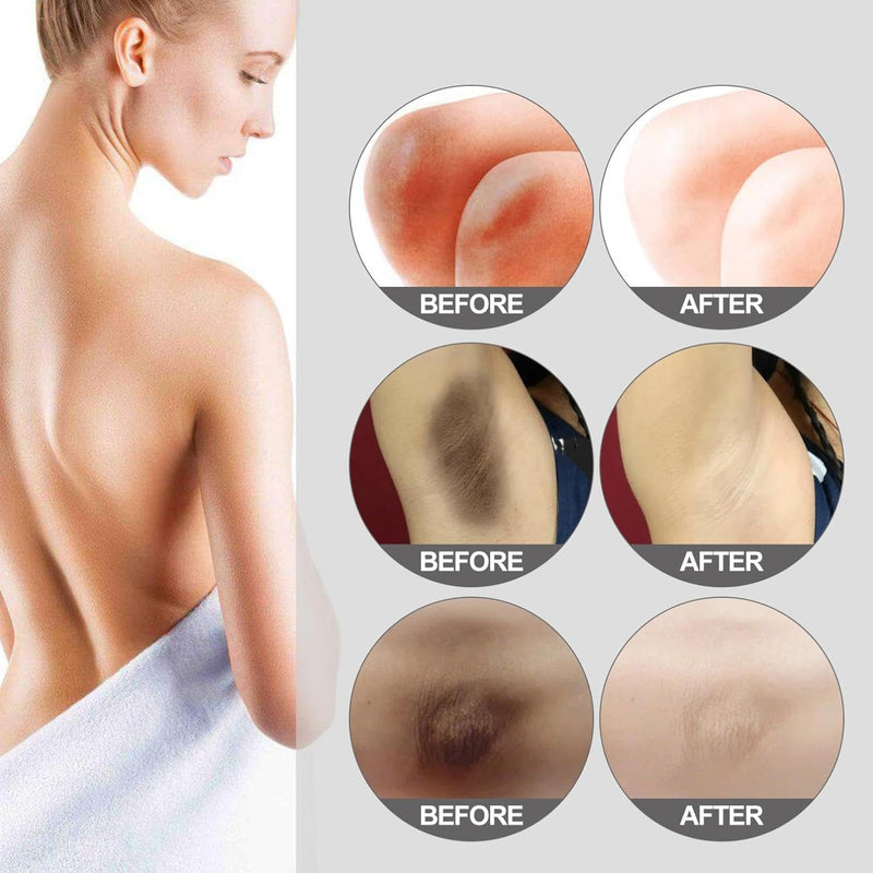 Bleaching Cream for the Inside of the Thighs, Skin Whitening Cream with Vitamin C and Pearl Extract, Improving Skin Tone Dark, 30 g - TUZZUT Qatar Online Shopping