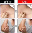 South Moon Antibacterial Cream 30g