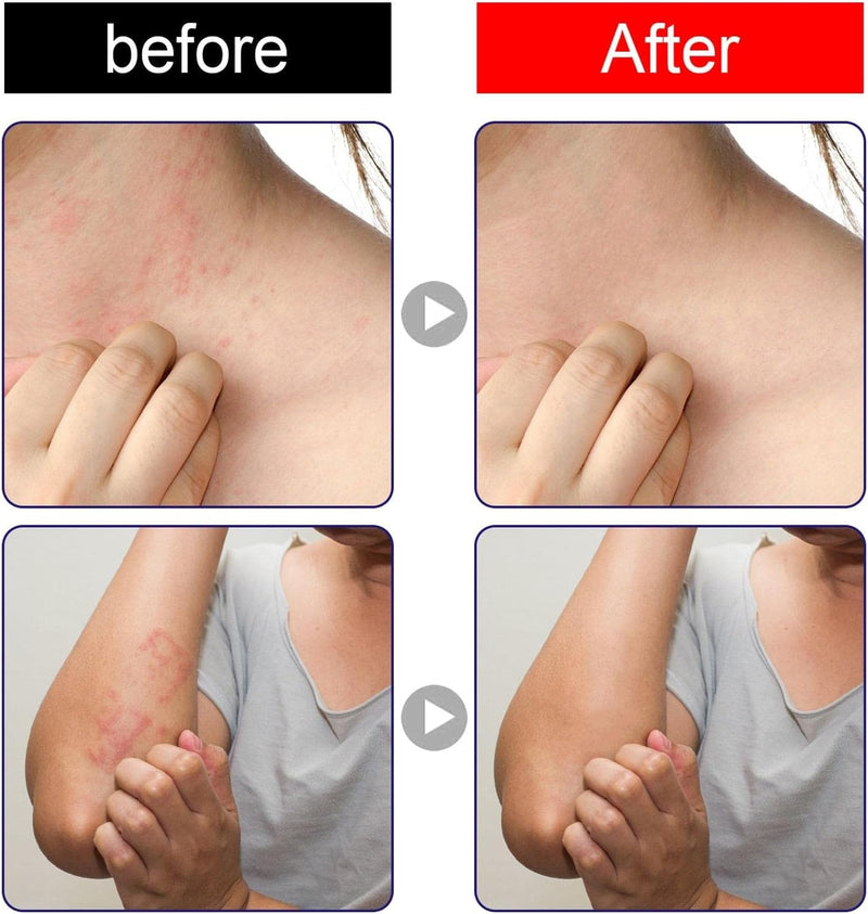 South Moon Antibacterial Cream 30g