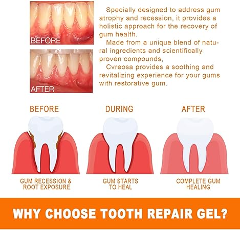 Gum Repair Essence Ampoules And Teeth Whitening Serum - 7pcs*1.5ml Gum Repair Essence Ampoules And Teeth Whitening Serum - 7pcs*1.5ml