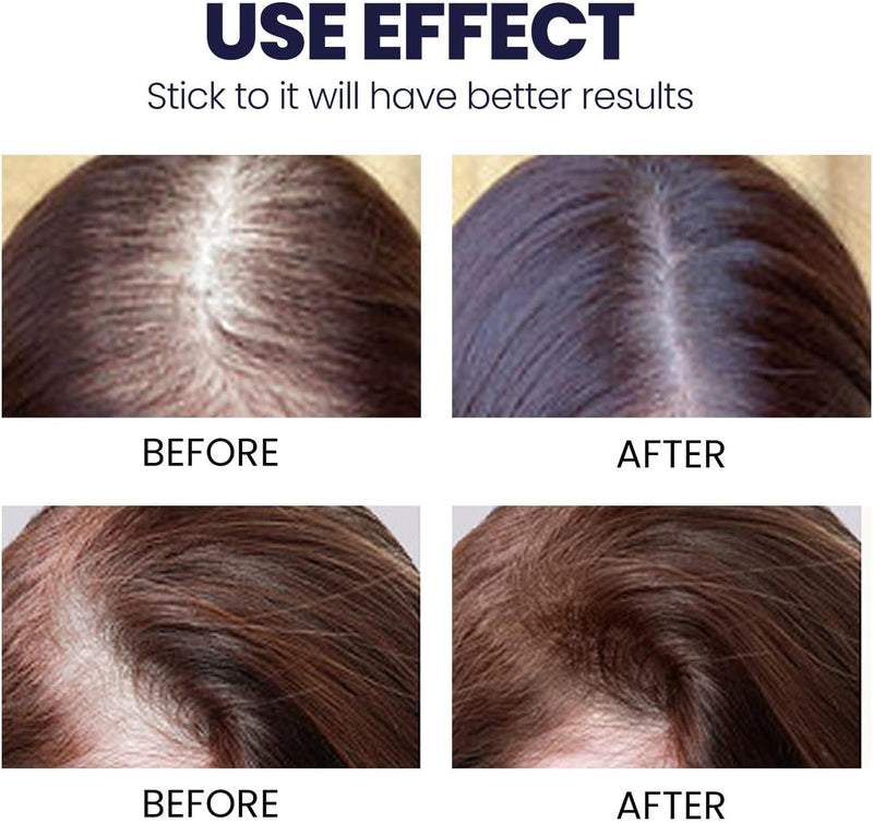 OUHOE Hair Growth Spray 50ml - TUZZUT Qatar Online Shopping