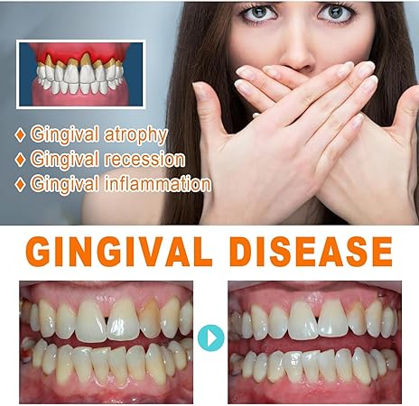 Gum Repair Essence Ampoules And Teeth Whitening Serum - 7pcs*1.5ml Gum Repair Essence Ampoules And Teeth Whitening Serum - 7pcs*1.5ml