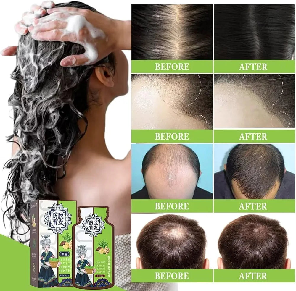 Ginger Plant Extract Convolute Anti-Hair Loss Shampoo Ginger Plant Extract Convolute Anti-Hair Loss Shampoo
