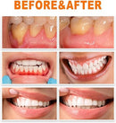 Gum Repair Essence Ampoules And Teeth Whitening Serum - 7pcs*1.5ml - TUZZUT Qatar Online Shopping