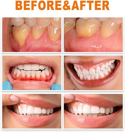 Gum Repair Essence Ampoules And Teeth Whitening Serum - 7pcs*1.5ml Gum Repair Essence Ampoules And Teeth Whitening Serum - 7pcs*1.5ml