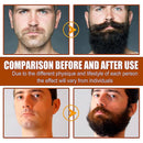 Beard Growth Essence Micro Needle Roller - Tuzzut.com Qatar Online Shopping