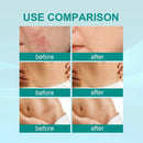 Scar Removal Spray Fade Scar -20g - Tuzzut.com Qatar Online Shopping