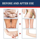 5pcs Wormwood Weight Loss Stickers Lazy Navel Bath Fat Burning - TUZZUT Qatar Online Shopping