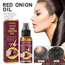 Red Onion Anti Hair Loss & Hair Growth Oil - Tuzzut.com Qatar Online Shopping