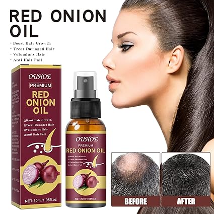 Red Onion Anti Hair Loss & Hair Growth Oil - Tuzzut.com Qatar Online Shopping