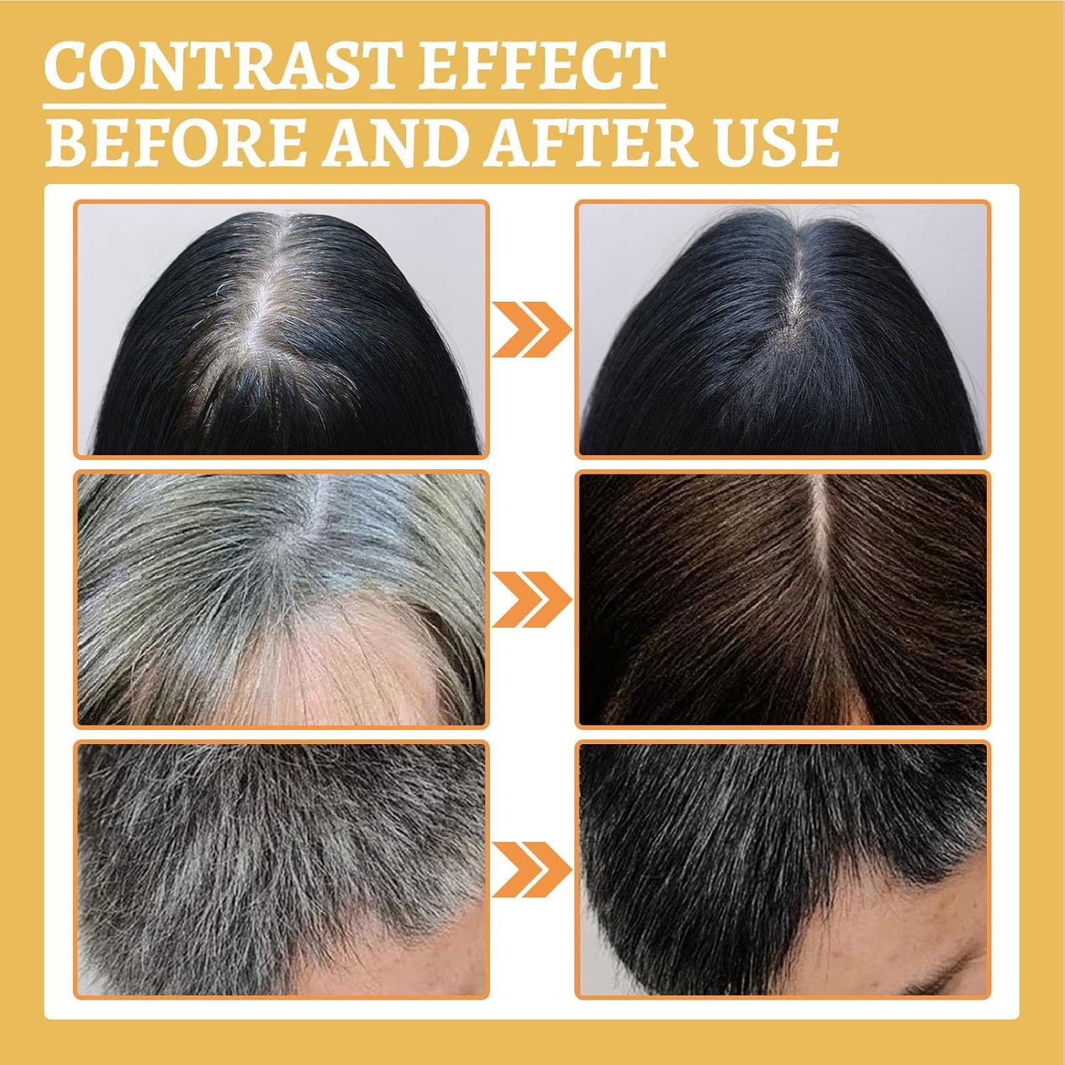 Nourishing Hair Oil, Deep Nourishing Liquid Against Grey Hair, 30 ml Prevention of Hair Loss and Natural Essence for Shiny Black Hair, Men and Women Nourishing Hair Oil, Deep Nourishing Liquid Against Grey Hair, 30 ml Prevention of Hair Loss and Natural Essence for Shiny Black Hair, Men and Women