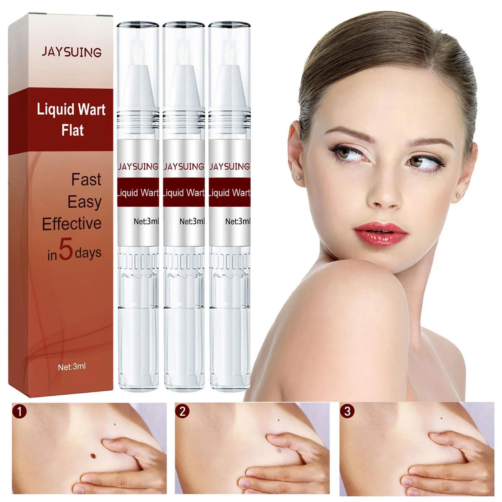 Wipe Off Tags and Mole Remover, Extreme Skin Tag Wipe Off Tags & Mole Remover 3ml Wipe Off Tags and Mole Remover, Extreme Skin Tag Wipe Off Tags & Mole Remover 3ml