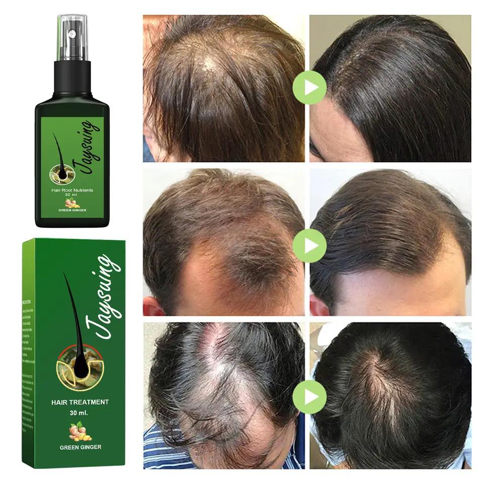 Natural Ginger Hair Growth Spray Jaysuing 120ml Natural Ginger Hair Growth Spray Jaysuing 120ml