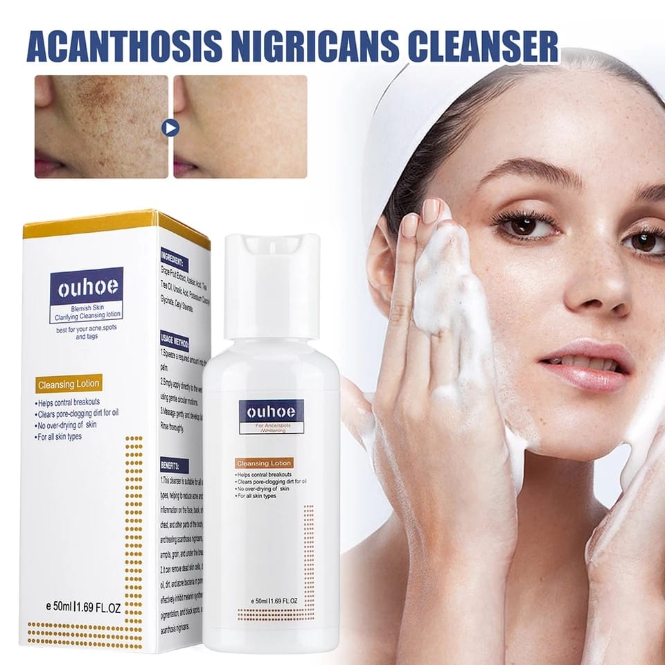 Ouhoe 2 Pcs Whitening Facial Cleanser Amino Acid Foam Scrub Cleansing Anti-Acne Oil 50ml Ouhoe 2 Pcs Whitening Facial Cleanser Amino Acid Foam Scrub Cleansing Anti-Acne Oil 50ml