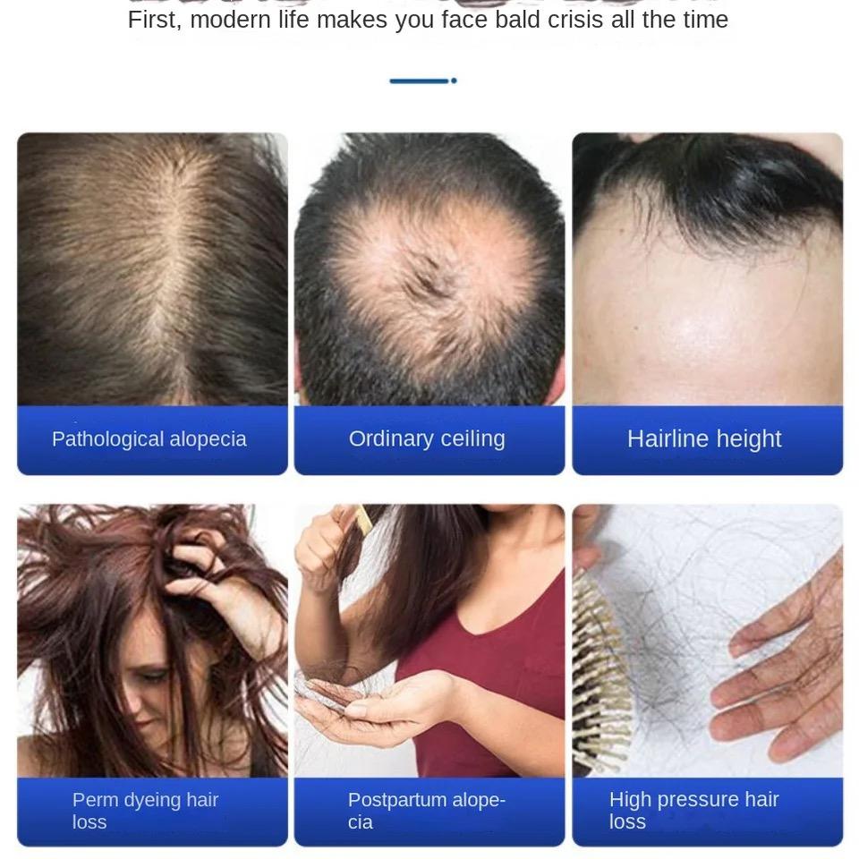 Dr Shampoo for Hair Loss Prevention with Traditional Chinese Medicine Dr Shampoo for Hair Loss Prevention with Traditional Chinese Medicine