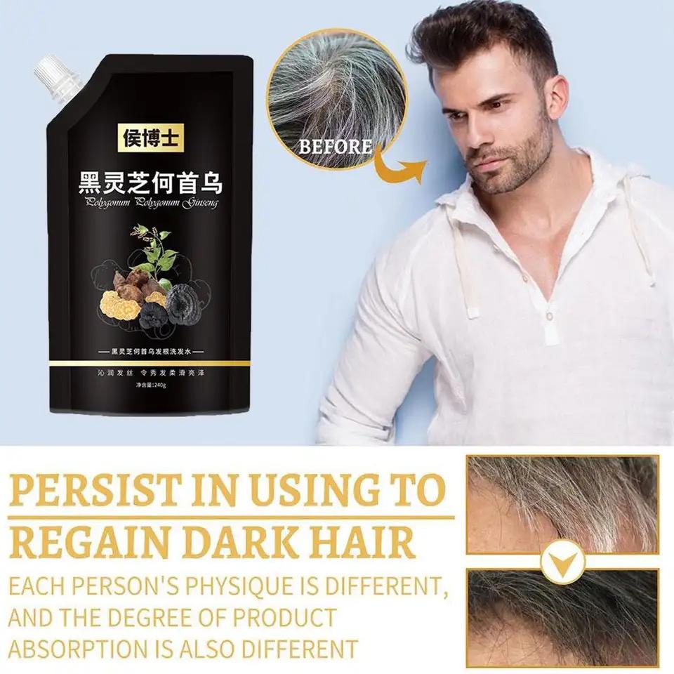 Polygonum Multiflorum Shampoo For White Hair Turns To Black Polygonum Multiflorum Shampoo For White Hair Turns To Black