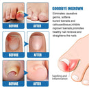 Toe Fungus Hand Foot Removal Gel Nail