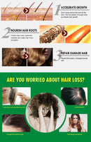 King Of Ginger 7 Days Ginger Germinal Oil Hair Tonic Growth Essence Anti-Fall Hair Treatment Care - Tuzzut.com Qatar Online Shopping