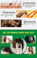 King Of Ginger 7 Days Ginger Germinal Oil Hair Tonic Growth Essence Anti-Fall Hair Treatment Care - Tuzzut.com Qatar Online Shopping