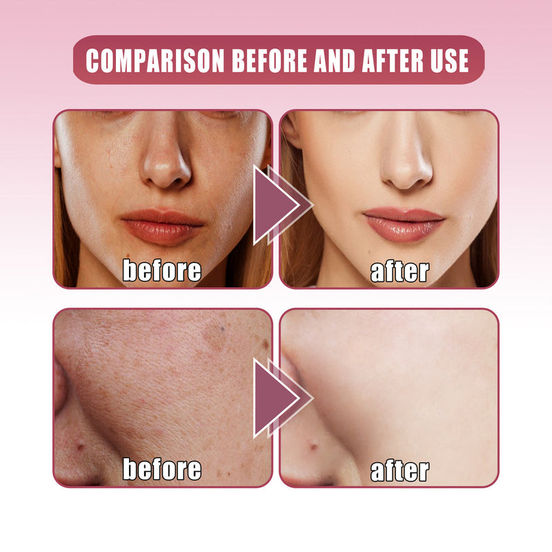 Jaysuing VA serum Turmeric Facial skin Repair oxidation liquid essence Beet Vitamin A(30ml) - Tuzzut.com Qatar Online Shopping