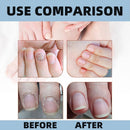 OceAura Nail Growth & Repair Serum 15ml - Strengthens & Hardens Damaged Nails - TUZZUT Qatar Online Shopping