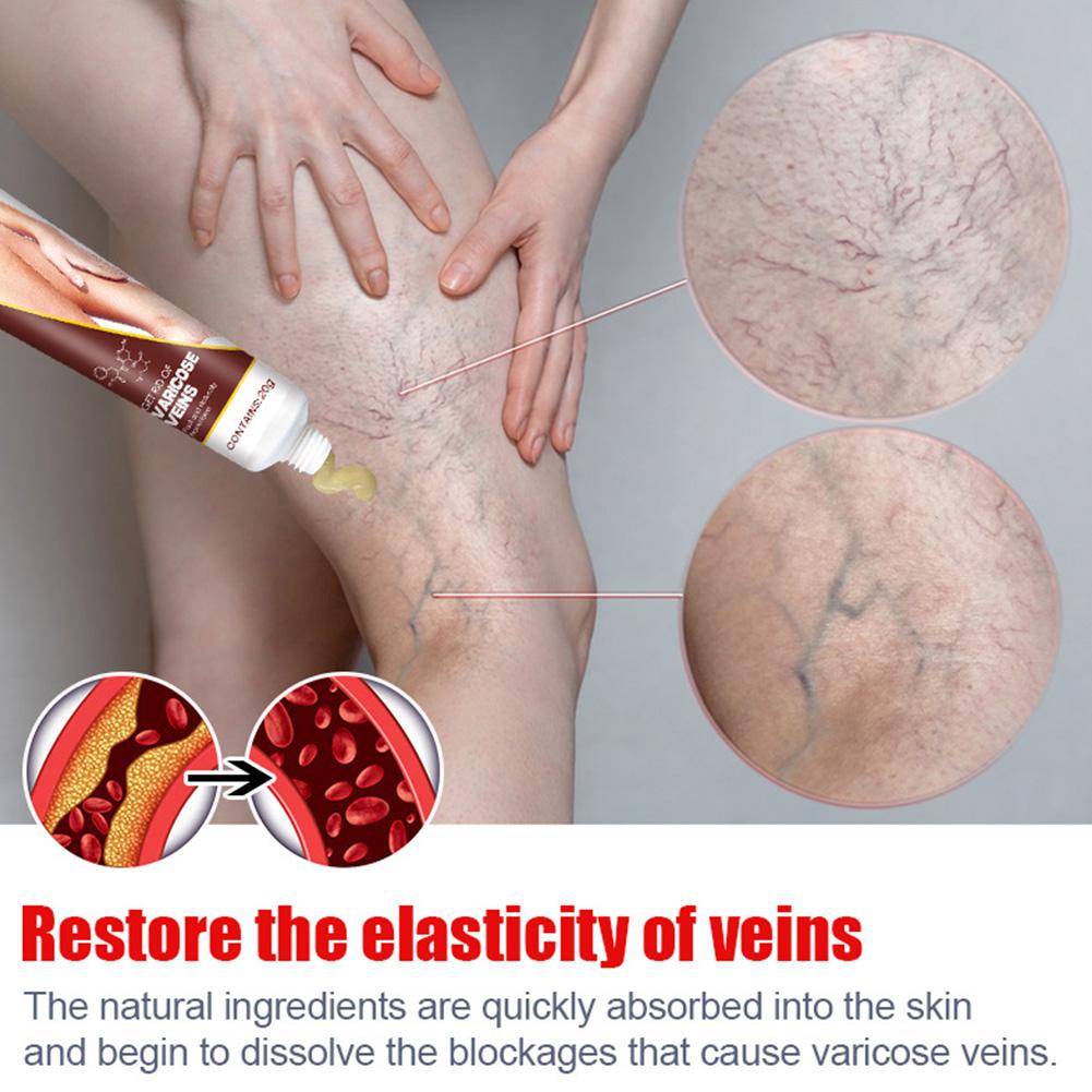 VEINS CREAM VEINS CREAM