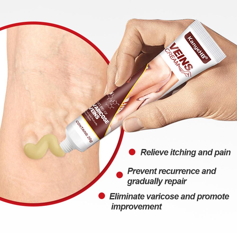 VEINS CREAM VEINS CREAM