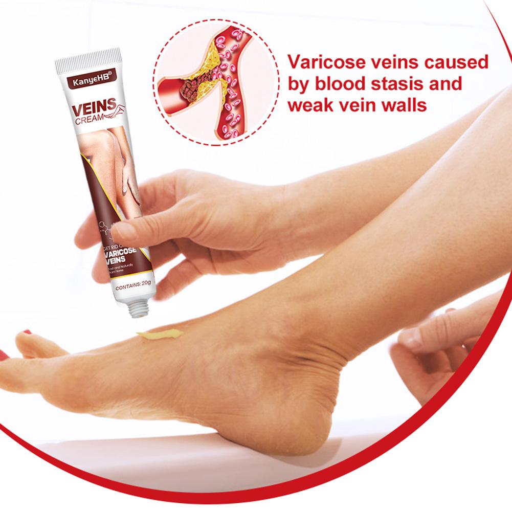 VEINS CREAM VEINS CREAM