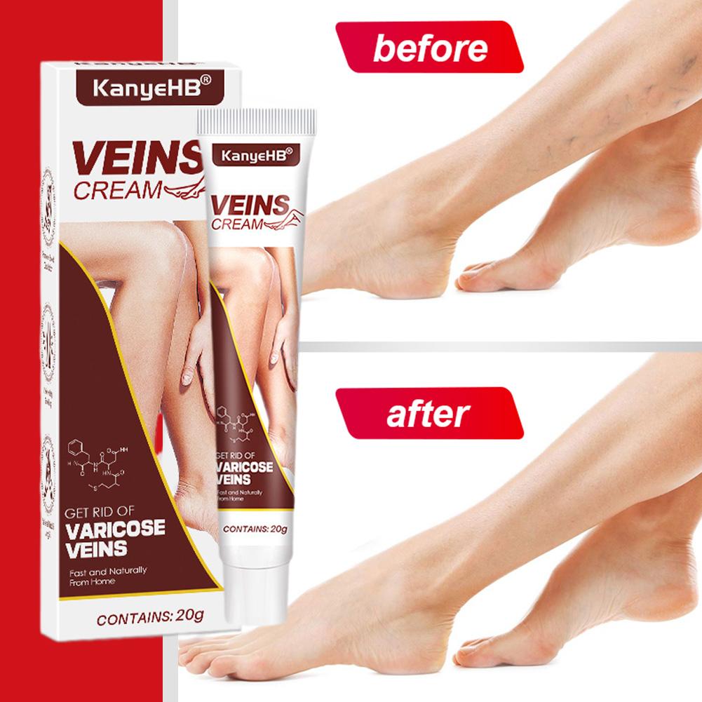 VEINS CREAM VEINS CREAM