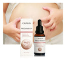 Abdominal Repair Oil for Stretch Marks 30ml - TUZZUT Qatar Online Shopping