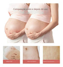 Abdominal Repair Oil for Stretch Marks 30ml - TUZZUT Qatar Online Shopping