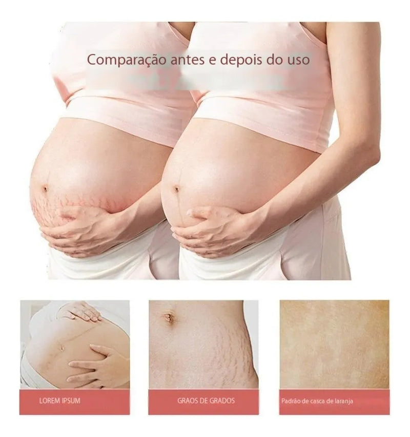 Abdominal Repair Oil for Stretch Marks 30ml - TUZZUT Qatar Online Shopping