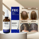 FEG Hair Growth Spray 100170 - TUZZUT Qatar Online Shopping