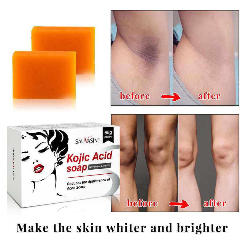 SAUVASINE Kojic Acid Soap
