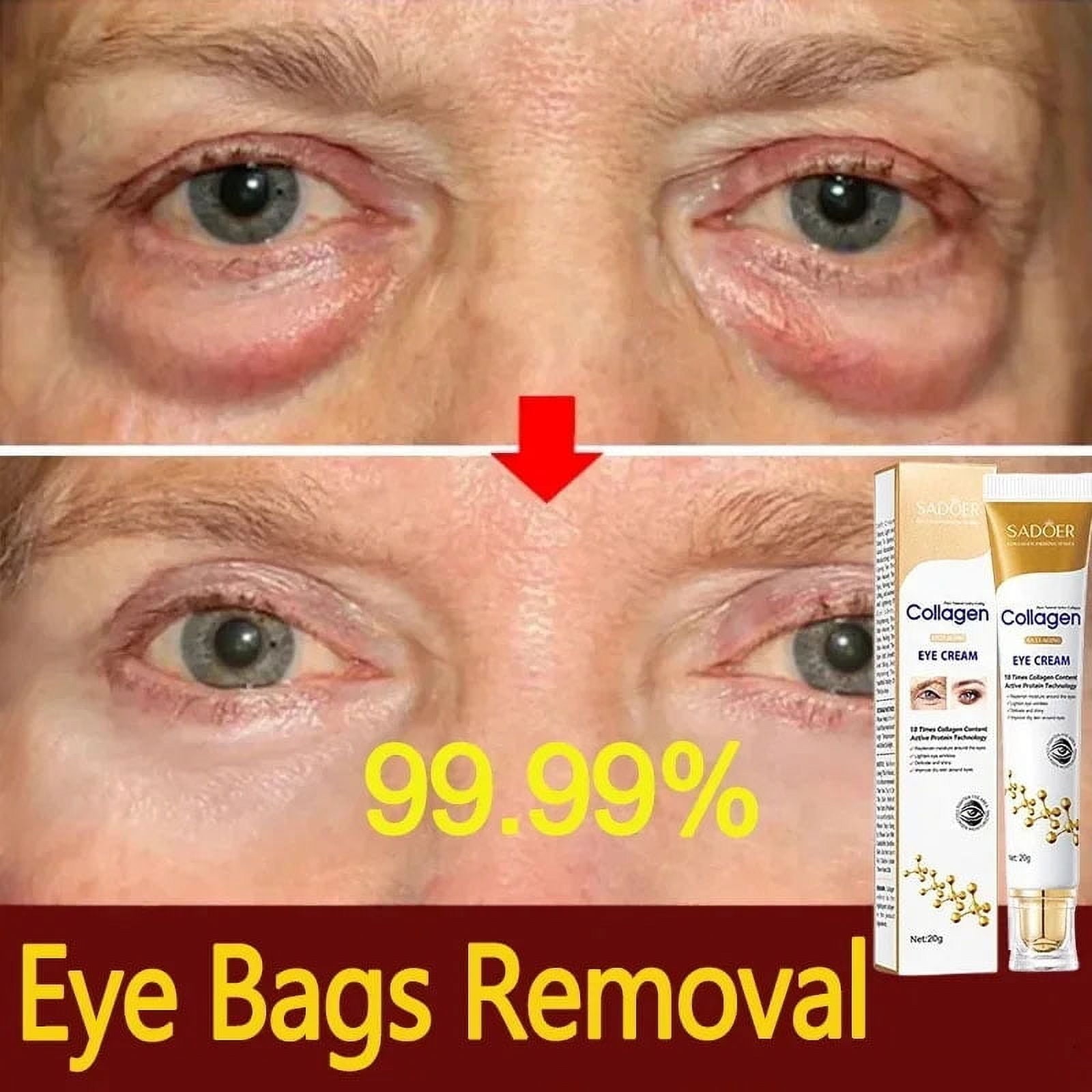 SADOER Collagen Instant Eye Bag Removal Cream 20g SADOER Collagen Instant Eye Bag Removal Cream 20g