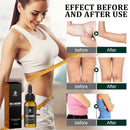 Ouhoe Calorie Blocking Serum, Skin Tightening Firming Serum, Ouhoe Collagen Lifting Body Oil 10ml