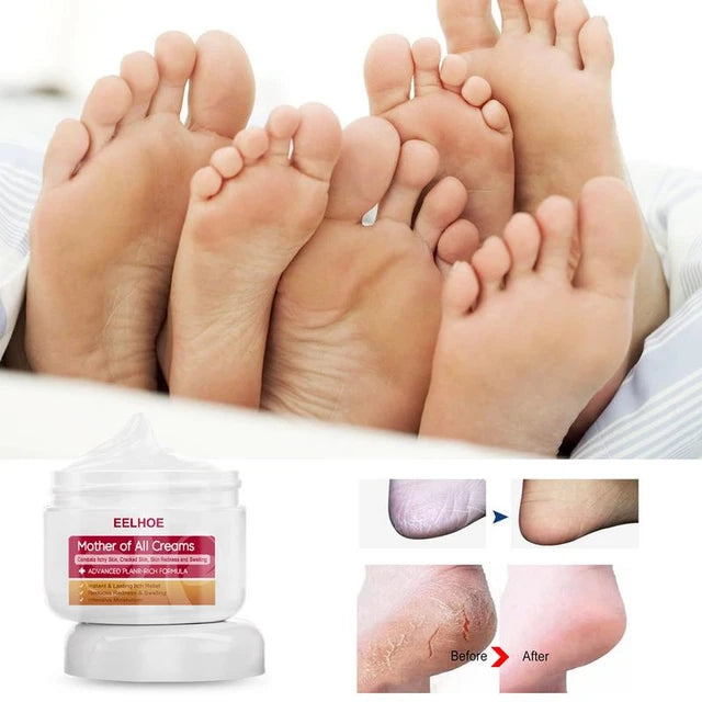 EELHOE Anti-Drying Crack Hand And Foot Skin Moisturizer Cream Hand And Feet Skin Care Repair Anti-cracking Moisturizing Cream - Tuzzut.com Qatar Online Shopping