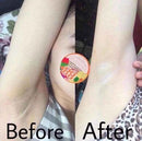 88 Total White Underarm Cream (35g) - 88TWUC - Tuzzut.com Qatar Online Shopping