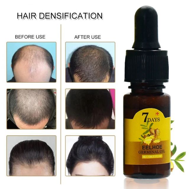Ginger Hair Growth Essential Oil Serum Hair Regrowth 7 Days Anti-Loss Repair Strong Roots Hair Care - Tuzzut.com Qatar Online Shopping