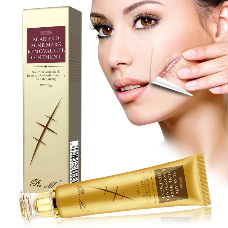 Acne scar remover cream, face cream gel skin care acne treatment cream 30g - Tuzzut.com Qatar Online Shopping