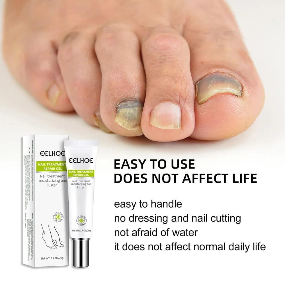 Nail Treatment Repair Gel 20g - Toe Health Foot Care Gel Nail Treatment Repair Gel 20g - Toe Health Foot Care Gel
