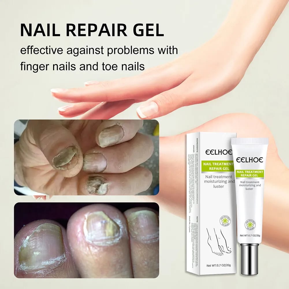 Nail Treatment Repair Gel 20g - Toe Health Foot Care Gel Nail Treatment Repair Gel 20g - Toe Health Foot Care Gel